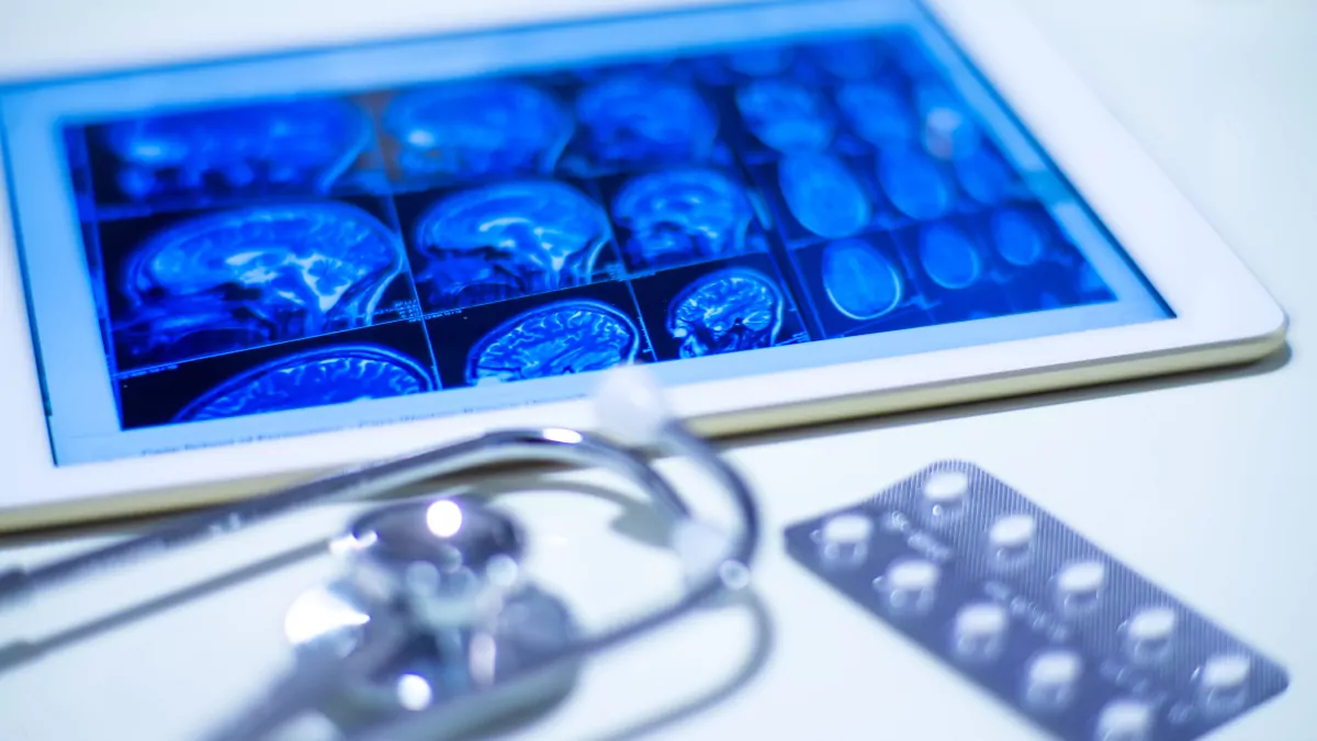 medical-concept-of-brain-scan-images-on-tablet-2022-11-14-07-04-42-utc-1